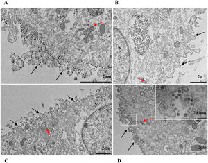 SARS-CoV-2 particles inside the cytosol (red arrows) and on the cell membrane (black arrow) of Vero-E6 cells. (A) Cell 48 hpi with Gamma. (B) Cell 48 hpi with Zeta. (C) Cell 48 hpi with Alpha. (D) Cell 48 hpi. with Delta. Nucleus (N). TEM images.