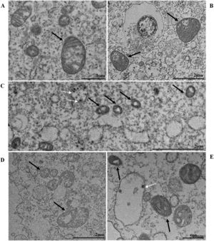 Mitochondrial ultrastructural alterations of Vero-E6 cells infected with SARS-CoV-2 variants. Uninfected Vero-E6 cell at 24 h of cultivation (control cell) (A), Vero-E6 cell 48 hpi with Gamma (B), and Alpha (C) and 24 hpi with Zeta (D) and Delta (E). Mitochondrial vacuolization (B‒E) and disorganization of mitochondrial crests (E). Mitochondria (black arrow), SARS-CoV-2 particles (white arrows). TEM images.