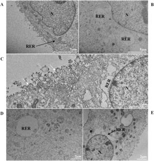 Thickening of the Rough Endoplasmic Reticulum (RER) in Vero-E6 cells infected with SARS-CoV-2 variants (B‒E). (A) Uninfected cell at 24 h of cultivation (cell control) (no RER thickening). (B) Cell 24 hpi with Gamma. (C) Cell 48 hpi with Alpha. (D) Cell 24 hpi with Zeta. (E) Cell 24 hpi with Delta. SARS-CoV-2 particles (white arrows). Nucleus (N). TEM images.