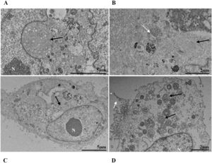 Myelin figures (black arrows) in Vero-E6 cells infected with SARS-CoV-2 variants at 48 hpi (A: Gamma, B: Alpha), 72 hpi (C: Zeta) and 24 hpi (D: Delta). SARS-CoV-2 particles (white arrows). Nucleus (N). TEM images.