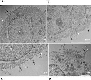 Filopodia and microvilli in the cell membrane (black arrows) in Vero-E6 cells infected with SARS-CoV-2 variants Gamma (A) and Alpha (B) at 48 hpi and Zeta (C) and delta (D) at 72 and 24 hpi, respectively. SARS-CoV-2 particles (white arrows). Nucleus (N). TEM images.