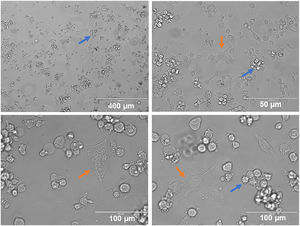 iDCs cells differentiated from THP-1 cells after 144 h. (A to D) Suspended cell clusters are observed with spicules (blue arrows) and other adhering cells with elongated conformation (orange arrows), both typical of iDCs.