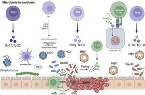 Microbiota in dysbiosis. The stimulation of T lymphocytes directly influences the functions of the intestinal epithelial barrier with the secretion of IL-17 and IL-22, determining the inflammatory state. Dendritic cells determine antigen exposure, with macrophages secreting cytokines IL-6, TNFα, and growth factor MMP-7 molecules, for phagocytosis and platelet stability in the lesion microenvironment. Th1 cells secrete IFN-γ and TNF-α in the pathological microbiome, with the presence of HBV or HCV in the infection there is an increase in Streptococcus, Bacilli and overexpression of bacterial toxins. RCTs (T-cell receptor) recognize microbial products and the infected cell by mediating cytotoxicity and cell apoptosis. The IL-10 and TGF-β of Tregs can induce overexpression of the inflammasome, leading to tissue damage, the progression of this inflammatory process favors hepatitis and HC. Effector T lymphocytes recognize the altered cell by mediating the antiviral action of IFN-γ, TNF-α, and secretion of perforin (PFN) and granzyme (GzmB) in the tumor microenvironment of the pathobiome.