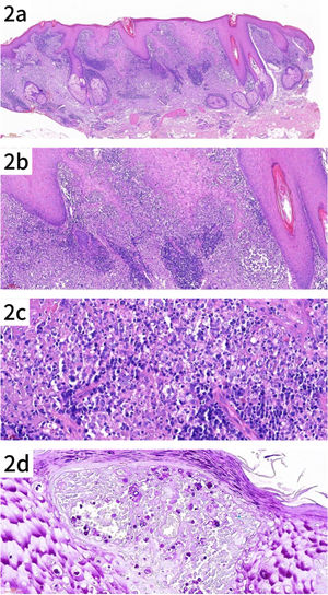 Histologic features of the patient