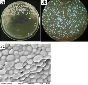 Growth and morphological characteristics of Prototheca wickerhamii under light and SEM. (a) Creamy, yeast-like colonies observed on SDA after 4 days of incubation at 30 °C. (b) Microscopic examination reveals numerous spores, some with visible septation. (c) SEM shows spherical clusters of Prototheca wickerhamii cells.