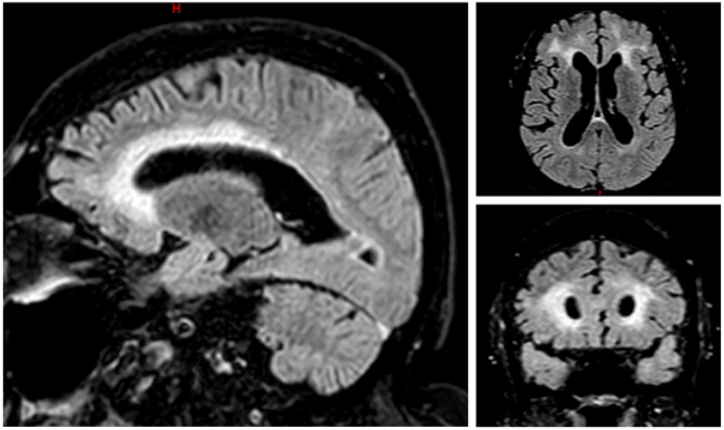 fig0002