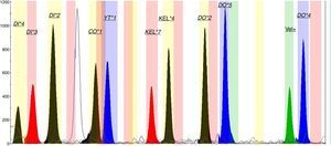 GeneMapper electropherogram of representative SNaPshot fragment in the analysis of the Wr(a+) donor.