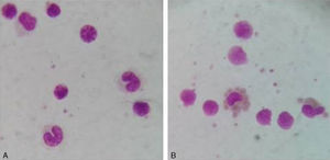 Monocyte monolayer assay slides (1000×). (A) Negative control and (B) Monocyte monolayer assay with anti-Wra.