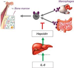 Pathophysiology of anemia associated with inflammatory process, highlighting the inhibitory action of hepcidin on iron release. IL: interleukin.