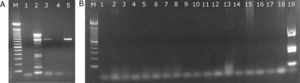 Agarose gel images of RT-PCR for MYST3-CREBBP fusion genes. Gel A, shows positive reactions for the MYST3-CREBBP fusion gene. Samples 2 (A) and 19 (B) are the positive controls in each reaction. Sample 1 (A and B) is the negative control (H2O only). Samples 3 and 5 (A) are from patients #1 and #11. In gel B, all samples are negative for the MYST3-CREBBP fusion gene; M: standard marker (100 base pairs)