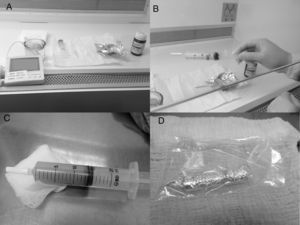 Process to manipulate all-trans retinoic acid (ATRA). (A) Materials: gown, gloves, class II-B2 biological safety cabinet, thermometer, 20-mL syringe, luer lock or other available syringe/lock system, light protection (e.g.: aluminum foil or other effective system), distilled water heated to 40°C and ATRA. (B) Syringe filled with 5–10mL of heated distilled water with ATRA and air space for effective mixing. (C) Final product after vigorous shaking. (D) ATRA protected from the light.