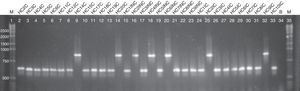 Agarose electrophoresis ABC genotyping of the C. albicans from the different studied groups, genotype A (C. albicans – 450bp) and B (C. albicans – 840bp). The lanes 2–14 correspond to the colonized group; 15–23 to the uncomplicated infection group and 24–33 to the complicated infection group. Lane 34 represents a blank; the lanes 1 and 35 indicate standard 1kb molecular weight markers (Invitrogen, Carlsbad, Ca, USA).