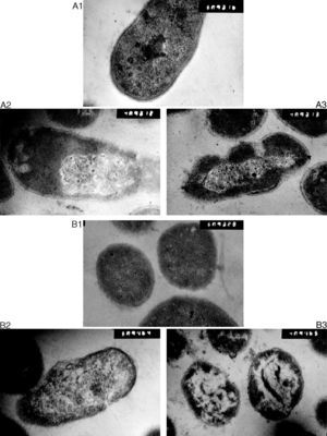 Ultrastructure of colistin treated A. baumannii cells. (A1,2,3): Sensitive A. baumannii A182 cells, (B1,2,3): Resistant (induced) A. baumannii A182 cells, A1 and B1 represent the control untreated cells for each category. Magnification: 40,000×: A2, A3, B3 and 50,000×: A1, B1, B2.