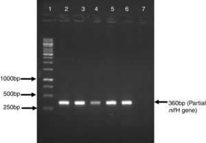 PCR-amplification of partial nifH from Azospirillum strains isolated from wheat rhizosphere. Lane 1: 1kb ladder (Fermentas, Germany); Lane 2: isolate AzoK1; Lane 3: isolate AzoK2; Lane 4: isolate AzoK3; Lane 5: isolate AzoK4; Lane 6: isolate AzoK5 and Lane 6: negative control.