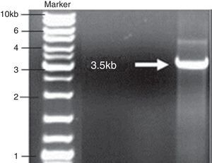 cry1Ab gene amplicon, Marker (Fermentas, SM 0331).