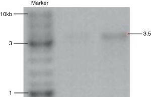 Validation of cry1Ab gene in positive clones using colony PCR, Marker (Fermentas, SM 0331).
