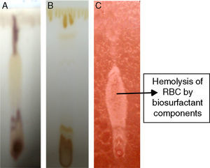 The TLC of biosurfactant developed using methanol:sulphuric acid (A), iodine vapor (B) and blood reagent (C).