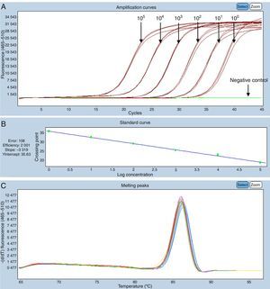 Standard curve SYBRGreen system, dilutions in extracts of CNS of cattle negative to OvHV-2. (A) Serial dilutions 100–105DNA copies/μL. (B) Specificity of the reaction: efficacy=2.001, slope=−3.319. (C) Melting curve generated in the SYBRGreen system, dilutions in extracts of CNS of cattle negative to OvHV-2 with peak at Tm 86°C.