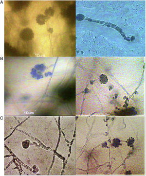 A 10××40× magnification images of sporangiophores (A) C. elegans (NCIM 689) (B) C. echinulata (NCIM 691) and (C) C. blakesleeana (NCIM 687).
