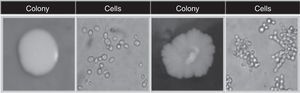 Colony (growing in YPD medium) and cells (magnification of 400× at optical microscopy) of a smooth colony (left) and a rough colony (right) of S. cerevisiae strains (Reprinted from Reis et al.4).
