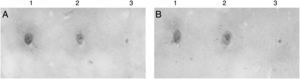 Dot blots of samples of broths fermented by recombinant Pichia pastoris cells preadapted in glycerol. (A) Bioreactor; (B) flask. 1. Positive control. 2. Broth sample. 3. Negative control.