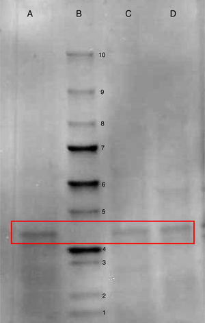 SDS-PAGE containing 12% polyacrylamide to confirm the production of the antibody fragment scFv anti LDL-ox. Well A: purified fraction from glycerol-based broth taken at the end of culture in bioreactor. Well B: unstained molar mass marker (Bio-Rad): 1=10kDa; 2=15kDa; 3=20kDa; 4=25kDa; 5=37kDa; 6=50kDa; 7=75kDa; 8=100kDa; 9=150kDa; 10=250kDa. Well C: purified fraction from glucose-based broth taken at the end of culture in flask. Well D: purified fraction from glycerol-based broth taken at the end of culture in flask. Boxes enclose the ≈28kDa antibody fragment.