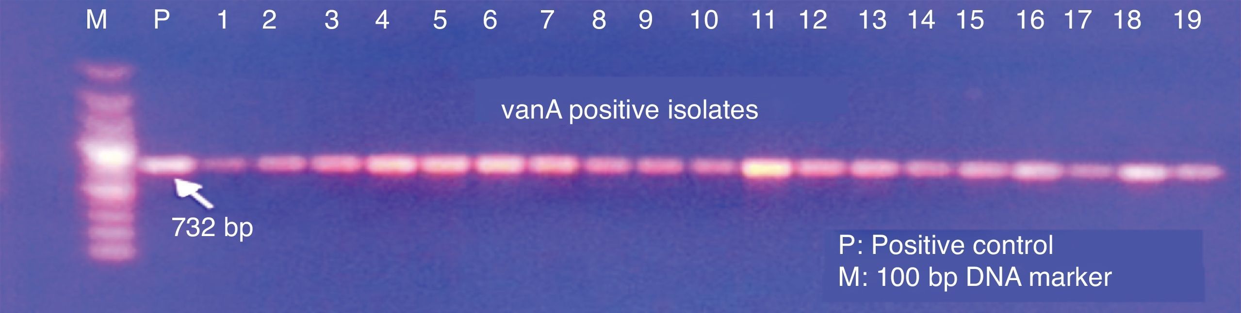 Vre Vanb Detection of vancomycin-resistant enterococci (VRE) in stool specimens ...