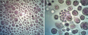 Light microscopy of cells in Antarctic strain 34-2 stained with methyl violet. A Vegetative cells (vc), sporangia (s) and ectoplasmic nets (arrows). Scale bar 100μm. B Mature sporangium with zoospores (z) and proliferative body (pb). Scale bar 50μm.
