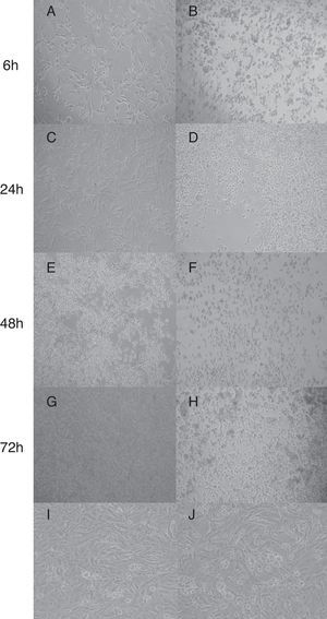 Cytotoxic of C. perfringens type A strain on Vero cells in different times. (A, C, E, G) C. perfringens tpeL (+) gene; (B, D, F, H) C. perfringens tpeL (−) gene; (I) Vero cells (control); (J) Vero cells and BHI. Times of Incubation: A and B, 6h; C and D, 24h; E and F, 48h; G and H, 72h. Magnification: 1000×.