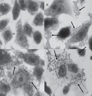 Adhesion assay of C. perfringens type A strain on HEp-2 cells. (A) HEp-2 control; (B) E. coli O42 (EAEC) strain; (C) C. perfringens ATCC 13124 strain, tpeL (−) gene; (D) C. perfringens 47d strain, tpeL (+) gene. Magnification: 1000×.