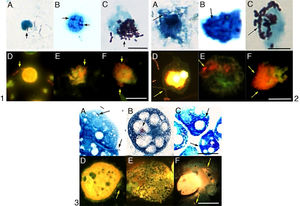 The intracellular growth of bacteria in different host cell. 1: the I2 in PBMCs; 2: the I5 in PMs; 3: the I5 in A. castellanii. A, B, C: penetration, intracellular growth at the 24th and 72nd hours in light microscopy; D, E, F: penetration, intracellular growth at the 24th and 72nd hours in epifluorescence microscopy. Sacale Bar=10μm in Picture 1; 25μm in Picture 2; 50μm in Picture 3 (100×).
