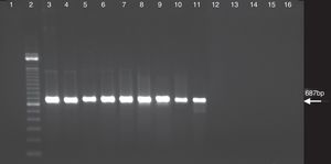PCR assay with C. burnetii performed with primers of first PCR as described in the materials and methods. Lanes: 1, negative control; 2, 100bp DNA ladder; 3, C. burnetii suspension 1× [21.4μg/mL]; 4, C. burnetii suspension 10×; 5, C. burnetii suspension 102×; 6, C. burnetii suspension 103×; 7, C. burnetii suspension 104×; 8, C. burnetii suspension 105×; 9, C. burnetii suspension 106×; 10, C. burnetii suspension 107×; 11, C. burnetii suspension 108×; 12, C. burnetii suspension 109×; 13, C. burnetii suspension 1010×; 14, C. burnetii suspension 1011×; 15, C. burnetii suspension 1012×; and 16, C. burnetii suspension 1013×.
