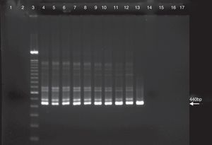 PCR assay with C. burnetii performed with primers of nested PCR as described in the materials and methods. Lanes: 1, negative control of first PCR; 2, negative control of nested PCR; 3, 100bp DNA ladder; 4, C. burnetii suspension 1×; 5, C. burnetii suspension 10×; 6, C. burnetii suspension 102×; 7, C. burnetii suspension 103×; 8, C. burnetii suspension 104×; 9, C. burnetii suspension 105×; 10, C. burnetii suspension 106×; 11, C. burnetii suspension 107×; 12, C. burnetii suspension 108×; 13, C. burnetii suspension 109×; 14, C. burnetii suspension 1010×; 15, C. burnetii suspension 1011×; 16, C. burnetii suspension 1012×; and 17, C. burnetii suspension 1013×.