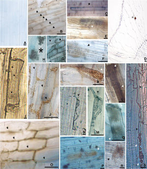 Morphological aspects of rice (var. Piauí) roots at 35 DAG on control (non-inoculated) and colonized by A103, A105, A104 and A101 fungi, unstained (d) or stained with methyl blue (others). (A) Non-inoculated control; (B–H) intercellular melanized hyphae forming structures resembling anastomoses (arrows) (B), a loose intracellular hyphal loop (arrow) (C), melanized intracellular microsclerotia (arrows) (E and F), a cross-section showing melanized intracellular microsclerotium (arrow) in the cortex region tissue of root (D), intracellular melanized septate hyphae (arrowhead) and a cell surrounded by melanized septate hyphae (arrow) (G), an intraradical chlamydospore-like structure (asterisk) in the vascular bundle region (H) formed by A103 fungus in the rice roots; (I–L) intracellular hyphae (arrowheads) (I), melanized intracellular microsclerotia (arrows) (K and L) formed by A105 fungus in rice roots; (M–R) intracellular hyphae (arrowhead) stained with methyl blue (M and N), intercellular melanized hyphae forming structures resembling anastomoses (arrows) (O), an early developmental stage of an intracellular microsclerotia (arrows) (P and Q), melanized microsclerotia (R) formed by A104 fungus in the rice roots; (S) intracellular melanized septate hyphae (arrowhead) and melanized microsclerotia (white arrows) formed by A101 fungus (R). DAG (days after germination). Bar=20μm.