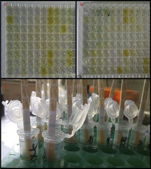 Comparison of three commercially available Copro-antigen tests. (A) RIDASCREEN®Cryptosporidium test [Enzyme Immunoassay (EIA)], (B) Cryptosporidium 2nd Generation [Enzyme Linked Immunosorbent Assay (ELISA)], (C) RIDA®QUICK Cryptosporidium [Immuno-chromatographic test (ICT)].