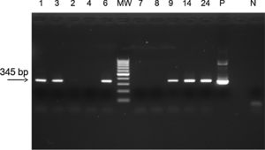 Agarose gel eletrophoresis of amplicons from PCR assay for ZIKV. MW, molecular weight marker (100bp); positive samples, 1, 3, 6, 9, 14, 24; negative samples: 2, 4, 7, 8; P, positive control for ZIKV (Zika virus strain MR 766); N, negative control. PCR assay showing the amplicon of 345bp of ZIKV.