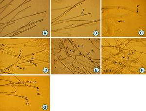 Morphological changes of the mycelia of plant pathogenic fungi upon interaction with endophytes isolated from soybean nodules. (A) Normal mycelia of Phytophthora sojae 01(CK); (B) mycelia became wrapped with biofilm formed by endophytic bacteria DD222 (1); (C) mycelia became fractured (2), lysis (3) under effect by endophytic bacteria DD161; (D) hyphae end became protoplast concentration and formed a ball (4, 5, 6, and 7) for mycelia unwrapped by biofilm under the action of DD201; (E) some aerial hyphae showed sarciniform (8) wrapped around each other (8) and twisted (9, 10) under the action of DD198. (F) Aerial hyphae became thin, transparent, and bent, and formed transparent liquid droplets (11, 12, 13, and 14) under the action of endophytic bacteria DD234; (G) hyphae end became split ends (15, 17) and protoplast concentration appeared spherical (16) under the action of endophytic bacteria DD176.