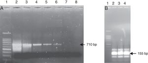 Nested-PCR using the primer pairs MW9/NW17 and NW11/NW12. (A) First-round PCR amplification with primer pairs MW9/NW17. Lane 1 DNA ladder; lane 2–7 contained different suspensions of Streptococcus pneumoniae: lane 2 – 106CFU/mL; lane 3 – 105CFU/mL; lane 4 – 104CFU/mL; lane 5 – 103CFU/mL; lane 6 – 102CFU/mL; lane 7 – 10CFU/mL; lane 8 – negative control. (B) Second-round of PCR amplification with primer pairs NW11/NW12. Lane 1 DNA ladder; lane 2, 3 contained 1μL from the first-round PCR; lane 2 – suspension 102CFU/mL of Streptococcus pneumoniae; lane 3 – suspension 10CFU/mL of Streptococcus pneumoniae; lane 4 contained 1μL of the negative reaction mixture from the first round. (C) Second-round of PCR amplification of the negative reaction mixture with primer pairs NW11/NW12. Lane 1 DNA ladder; lane 2–6 contained 1μL of the negative reaction mixture from the first round; lane 2 negative reaction mixture without pretreatment; lane 3–6 negative reaction mixture treated with 1U, 1.25U, 1.5U and 2U of DNase I, respectively.