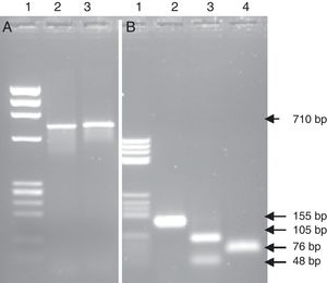 PCR-RFLP from the heart valve and the strain isolated from patients with suspected infective endocarditis with the enzymes EcoRI, FokI and DdeI. (A) PCR product amplified from the isolated strain; lane 1 DNA ladder; lane 2 PCR product non-digested; lane 3 PCR product digested with the enzyme EcoRI. (B) PCR product amplified from the heart valve; lane 1 DNA ladder; lane 2 PCR product non-digested; lane 3 PCR product digested with the enzyme Fok I; lane 4 PCR product digested with the enzyme DdeI.