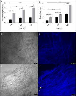 Influence of elastin on the growth of A. fumigatus biofilm. The graphics represent the mean values with SDs of the biofilm production of both isolates of A. fumigatus measured by absorbance with 0.5% crystal violet (A) and (B) the dry weight. A significant increase in the presence of 10mg/mL of elastin (gray bars) compared to RPMI alone (black bars) was observed for all time periods (**p<0.01; ****p<0.0001; ANOVA); (C) A. fumigatus URM6575 biofilm grown in RPMI is shown after 48h at 37°C under light in microscopy and (D) stained with Calcofluor White® (E) and in RPMI supplemented with 10mg/mL of elastin under microscopy and (F) stained with Calcofluor White®. An increased amount of biofilm was produced in the presence of elastin (10mg/mL). Circular arrangements (yellow arrow) and parallel bundles of hyphae (black arrow) are shown. Scale bar, 50μm.