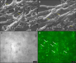Enhanced production extracellular matrix (ECM) of A. fumigatus biofilm. Photomicrographs taken by scanning electron microscopy analysis of A. fumigatus URM6575 biofilm in RPMI (A) and RPMI with elastin (B) show increased production of ECM in the presence of elastin (yellow arrow). Magnification of 2000×. A. fumigatus URM6575 biofilm grown in RPMI supplemented with 10mg/mL of elastin (C) under light microscopy and stained with concanavalin A-Alexa Fluor 488® (D) show greater amounts of ECM at the ends of the hyphae (white arrow). Scale bar, 50μm.