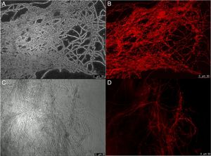 Decreased hydrophobicity of A. fumigatus biofilm. A. fumigatus URM5992 (environmental origin) biofilm after 48h at 37°C. (A and B) Biofilm Grown in RPMI without elastin under light microscopy and stained with latex beads, respectively. (C and D) biofilm grown in RPMI with elastin – 10mg/mL under light microscopy and stained with latex beads, respectively. Scale bar, 50μm.