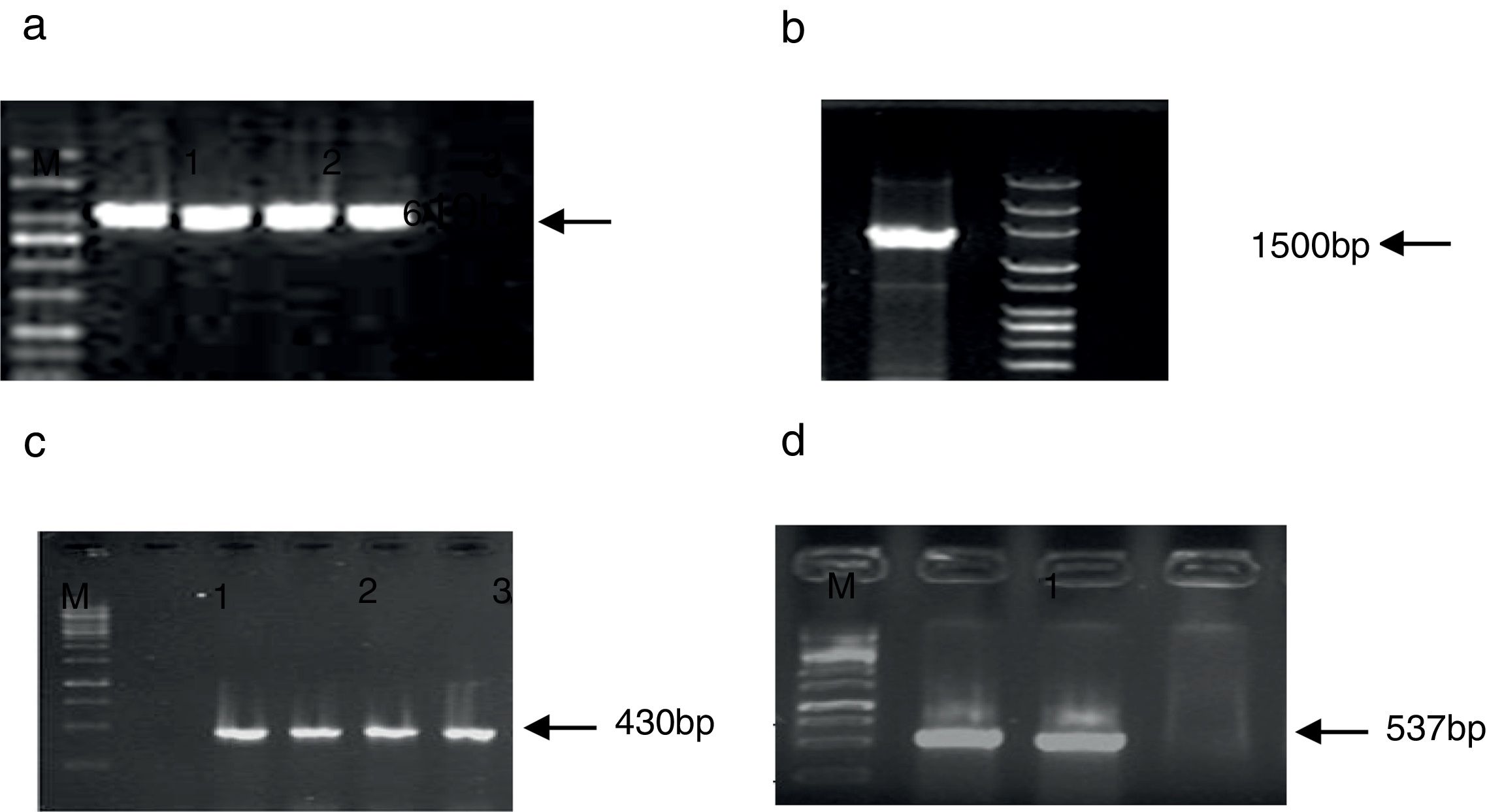 Enterobacterial repetitive intergenic consensus (ERIC)-PCR analysis as ...