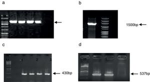 PCR amplification of ipaH gene. Lane 1: positive control; Lane 2–4: positive isolates; Lane 5: negative control; M: mid-range DNA ladder (100bp to 3kb). PCR amplification of fliC gene. Lane 1: Shigella flexneri ATCC1202 and M: mid range DNA ladder (100bp to 3kb). PCR amplification of wbgZ gene in Shigella spp. L. Lane 1: negative control; Lane 2: positive control; Lane 3–5: positive isolates; M: 1kb DNA ladder. PCR amplification of rfc gene in Shigella spp. Lane 1: positive control; Lane 2: positive isolate; Lane 3: negative control; M: 1kb DNA ladder.