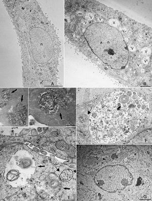 Transmission electron microscopy (TEM) analysis of bovine viral diarrhea virus (BVDV)-infected cells treated with prostaglandin A1 (PGA1). Infected and non-infected MDBK cells were treated with PGA1 for 36h, and then processed for routine TEM. Vacuoles (v) were rare or absent in the majority of sections from non-infected cells (A), but were abundant in BVDV-infected cells not treated with PGA1 (B). Many of these structures exhibited extracellular content, as shown by ruthenium red labeling (arrows) in traditional (C) and en face (D) sections. Treatment with 1μg/mL (E) or 2.5μg/mL (F) PGA1 could not prevent BVDV-induced vacuolization in infected cells, which had large vacuoles (arrows) with multilamellar structures (arrowheads), and often surrounded by smaller vesicles-containing vacuoles (thin arrows). (G) Treatment with 10g/mL PGA1, however, dramatically reduced virus-induced vacuolization. n, nucleus. Scale bars: (A) 5μm; (B, G) 2μm; (C, E) 500nm; (D, F) 1μm.
