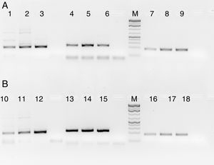PCR products of three HIV, HBV and HCV samples with and without RecA. Panel A shows PCR without RecA, while panel B shows PCR with RecA. Lanes 1, 2, 3, 10, 11 and 12 are HIV samples; lanes 4, 5, 6, 13, 14, and 15 are HBV samples; lanes 7, 8, 9, 16, 17, and 18 are HCV samples. RT-PCR was performed for the HIV and HCV samples as described in the M & M section, while for HBV, regular PCR was performed as per the protocol described in the M & M section.