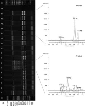 REP-PCR amplification of X. euvesicatoria strains with ERIC primers. On the left: M-DNA ladder; lanes 1–5, 8–17 – representative X. euvesicatoria strains forming profile I; lanes 6, 7 – representative X. euvesicatoria strains forming profile II; lane 18 – PCR mix. On the right: graphs of the two profiles. The numbers at the tops of the peaks correspond to the lengths of the amplicons.