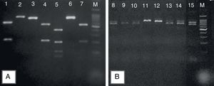 Representative 2% agarose gel of Candida parapsilosis sensu lato, after specific PCR reactions. (A) Products obtained after the digestion of sadh gene – PCR fragments by the BanI restriction enzyme distinguishing the cryptic species: C. parapsilosis sensu stricto (lines 1, 4, 7); C metapsilosis (line 5); and C. orthopsilosis (lines 2, 3, 6); (B) the band patterns of 716bp, obtained after sadh gene PCR reaction, suggestive of C. parapsilosis sensu lato (lines 11 and 12) and unspecific band patterns obtained for Candida guilliermondii (lines 8, 9, 10, 13, 14 and 15). Molecular marker: 1000bp.