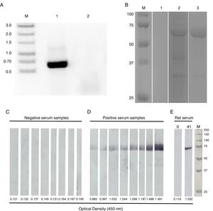(A) Polymerase chain reaction (PCR) amplification of the nucleotide sequence corresponding to the BLV capsid protein gene. Lymphocytes from BLV-infected cows (lanes 1) and from a non-infected cow (lane 2) were used for DNA extraction and analyzed by PCR. The fragment amplified was 666 nucleotides in length. M: 1 Kbp molecular weight markers. (B) Analyses of the recombinant BLV capsid protein (BLV p24r). Samples were collected prior to IPTG induction (lane 1), after overnight induction (lane 2), and after purification by the HisTrap column (lane 3), analyzed by SDS-PAGE and stained by Coomassie blue. The size of the molecular weight markers is indicated on the left side. (C) Western blot analysis of the BLVp24r protein. The purified BLVp24r protein resolved by SDS-PAGE and transferred to nitrocellulose membrane. Membrane strips containing the BLVp24r were incubated with serum from non-infected (panel C; n=8) and naturally BLV-infected (panel D; n=8) cows, and with rat serum (panel E) collected prior to (day 0) or after immunization (day 41) with the BLVp24r. All sera were also evaluated by our in house iELISA and the optical density (OD450nm) of each serum is indicated below the strips. M: molecular weight markers.