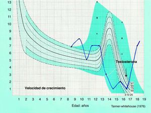 Gráfico de la evolución de la velocidad de crecimiento del caso descrito. La flecha indica el inicio del tratamiento con testosterona.